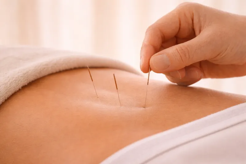 Patient bei der Akupunkturbehandlung am Rücken